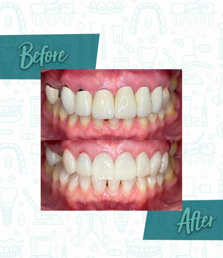Steps to take during a dental emergency
