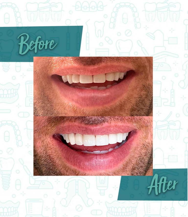 When to see a dentist for persistent or severe tooth pain